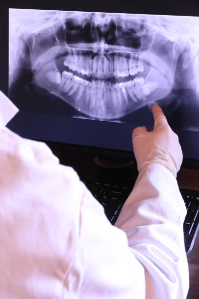 Best Root Canal Emergency Dentist  in Grandview, IL